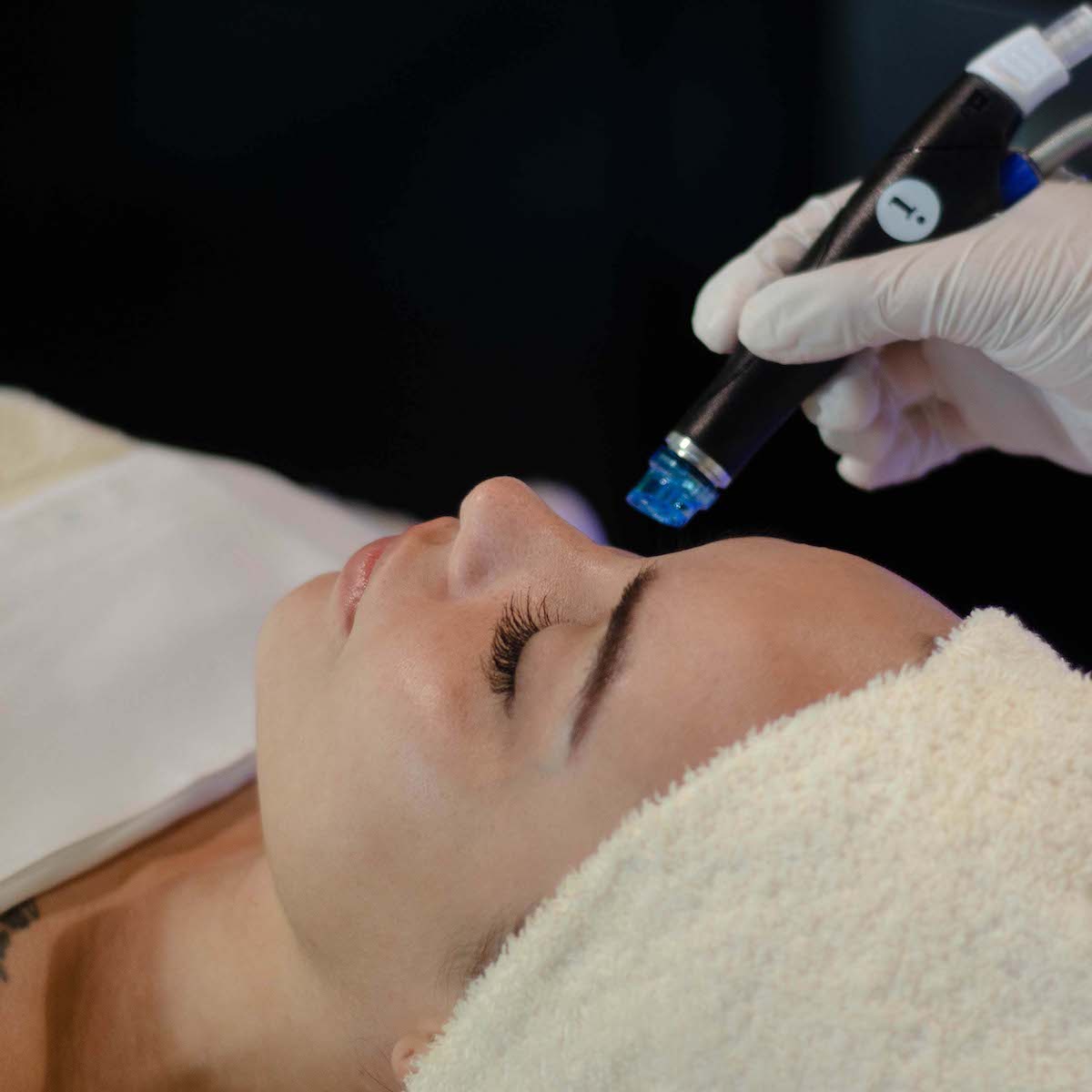 Hydrafacial Treatment